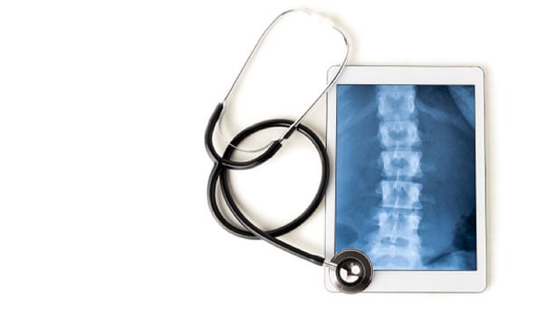 Stethoscope next to a tablet computer showing a spinal X-ray on the screen
